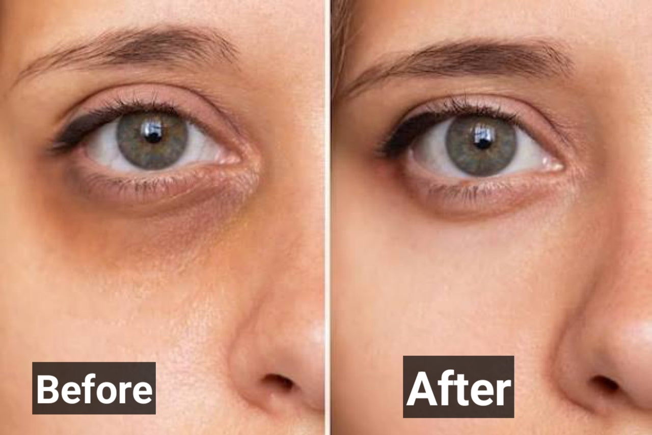Glowrify Eyelight Serum – Dark Circles & Puffy Eyes Solution (10ML)