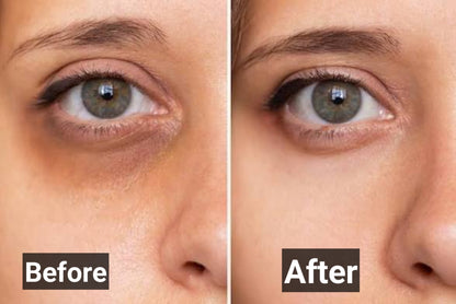 Glowrify Eyelight Serum – Dark Circles & Puffy Eyes Solution (10ML)
