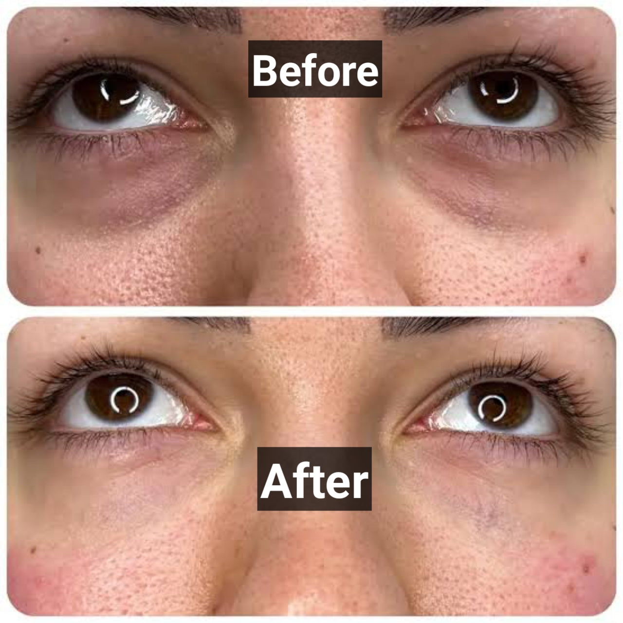 Glowrify Eyelight Serum – Dark Circles & Puffy Eyes Solution (10ML)