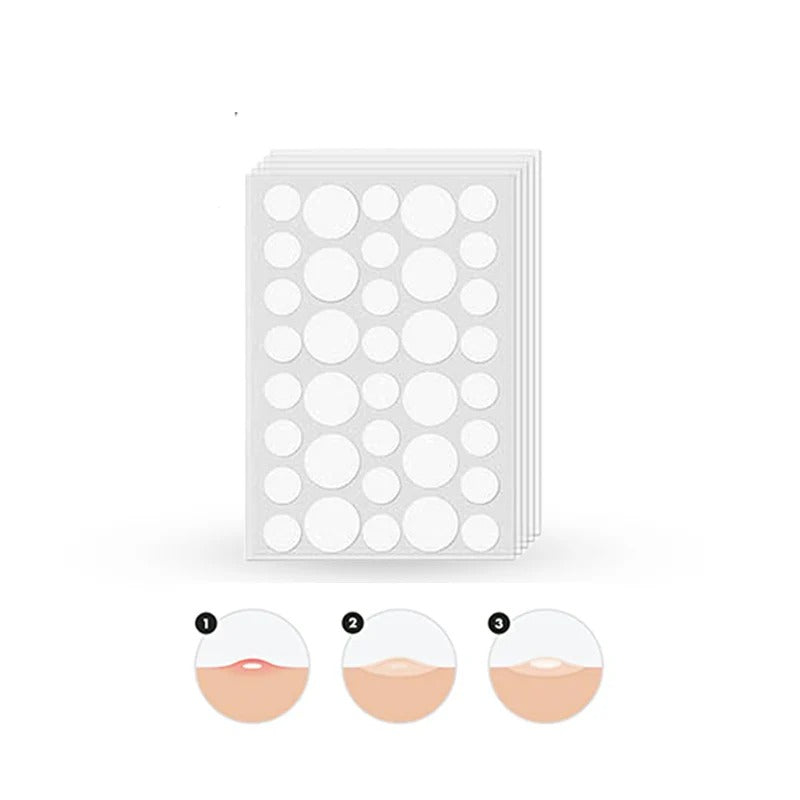 Glamorous Face Acne Pimple Patch – 72 Patches