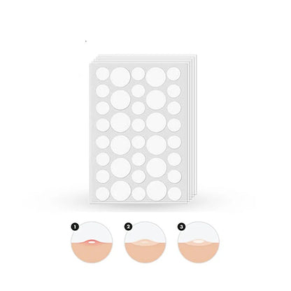 Glamorous Face Acne Pimple Patch – 72 Patches