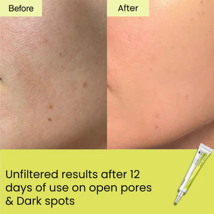 Retinal Shot Tightening Booster – Anti-Aging & Skin Firming Serum